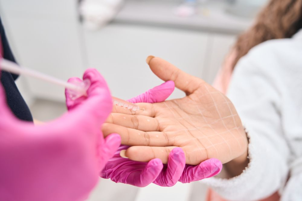 medico sta facendo iniezioni sottocutanee alla mano della paziente per sudorazione alle mani
