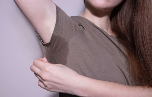 Che cos’è la sudorazione eccessiva (iperidrosi)?